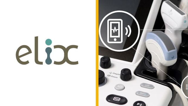 恩智浦携手Elix打造量产医疗流传输解决方案